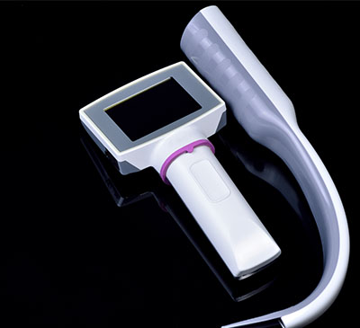 Video Laryngoscopes Market by Product and Geography - Forecast and Analysis 2020-2024
